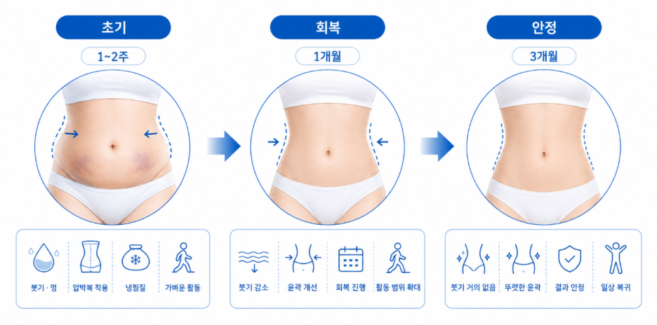 복부지방흡입 후 회복 과정, 언제부터 라인이 달라질까요? 관련 이미지 4