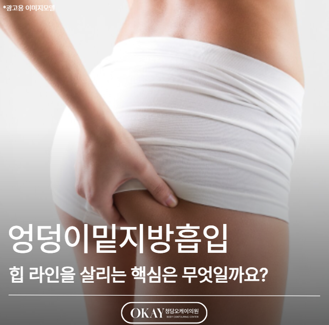 엉덩이밑지방흡입, 힙 라인을 살리는 핵심은 무엇일까요? 관련 이미지 1