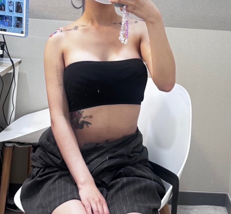 Square Shoulder Filler: Explaining the Effects, Price, Reviews, and Side Effects image 7