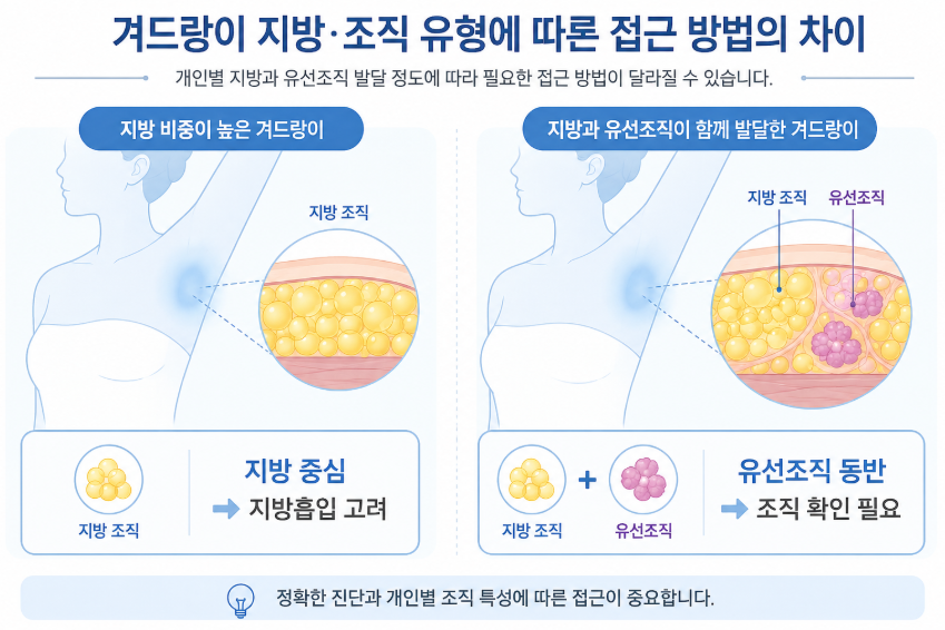 부유방수술비용, 지방흡입만 하면 더 저렴할까요? 관련 이미지 6