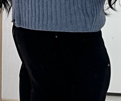 청담동성형외과 잘하는곳 찾는다면 재수술 상담에서 확인해야 할 기준 관련 이미지 12