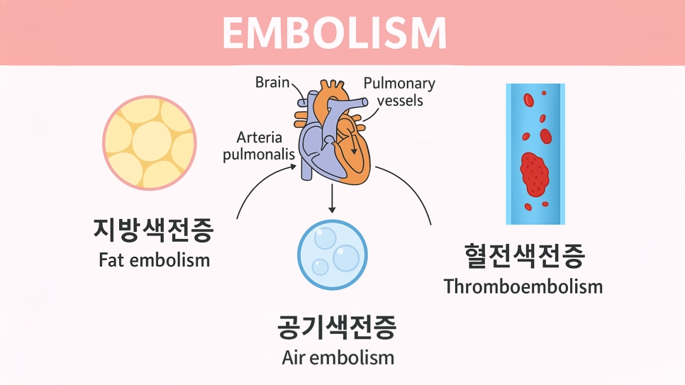[청담오케이의원] 지방흡입, 정말 안전한 수술일까? 관련 이미지 3