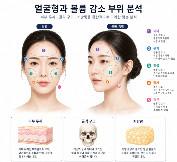 풀페이스필러 vs 얼굴지방이식, 나에게 더 잘 맞는 방법은 무엇일까요? 관련 이미지 7