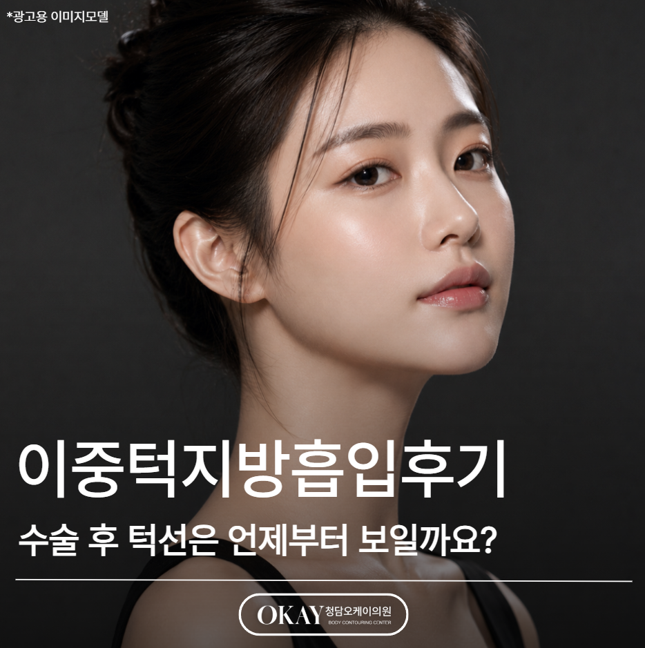 이중턱지방흡입후기, 수술 후 턱선은 언제부터 보일까요? 관련 이미지 1