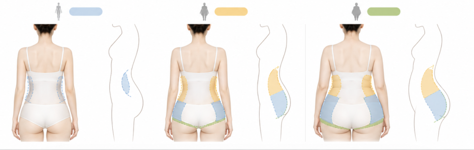 허파고리술가격, 후회하지 않으려면 확인해야 할 4가지 관련 이미지 9