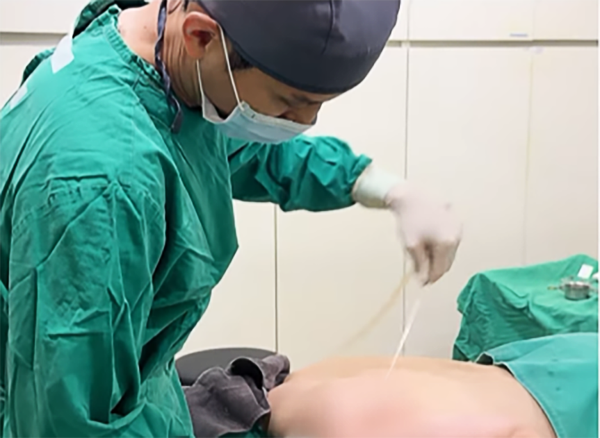 서울지방이식잘하는곳 왜 차이 날까? 가격·효과·후기 그리고 부작용 체크 관련 이미지 14
