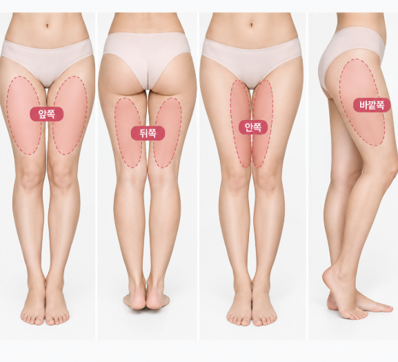 허벅지지방흡입, 다이어트해도 허벅지만 안 빠지는 이유는? 관련 이미지 5