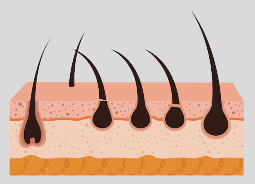 Why Results End Up Bad After Finding a ‘Hair Transplant Hotspot’ Clinic in Seoul: This Is Where It Comes Down to the Details image 6