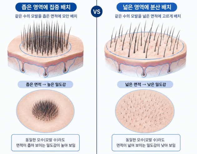 How Much Can 3,000 Hair Grafts Cover? image 8