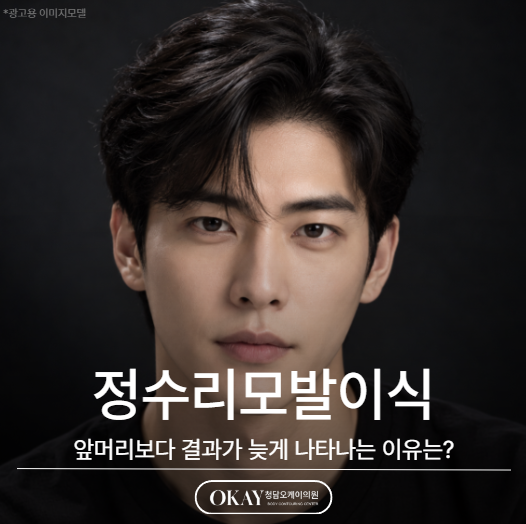 정수리모발이식, 앞머리보다 결과가 늦게 나타나는 이유는? 관련 이미지 1