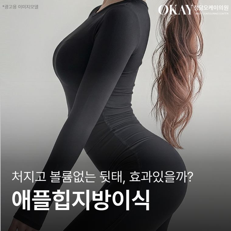 애플힙지방이식 효과, 전후 변화&middot;생착률&middot;유지기간까지 정리 관련 이미지 1