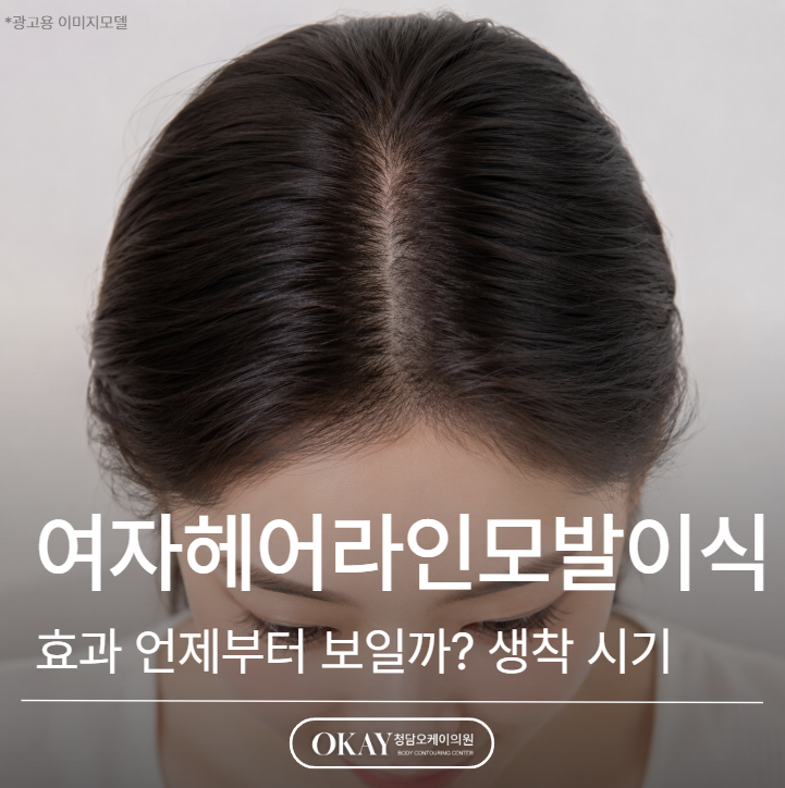 여자헤어라인모발이식 효과 언제부터 보일까? 생착 시기&middot;회복기간 설명 관련 이미지 1