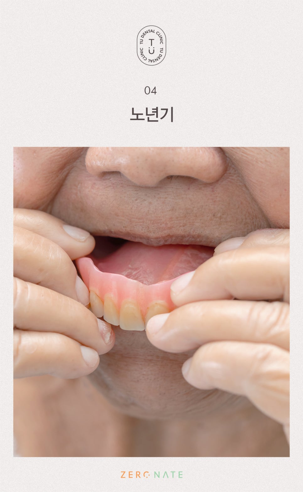 티유치과 연령대별 치아관리법을 알려드립니다[TU치과] 관련 이미지 5