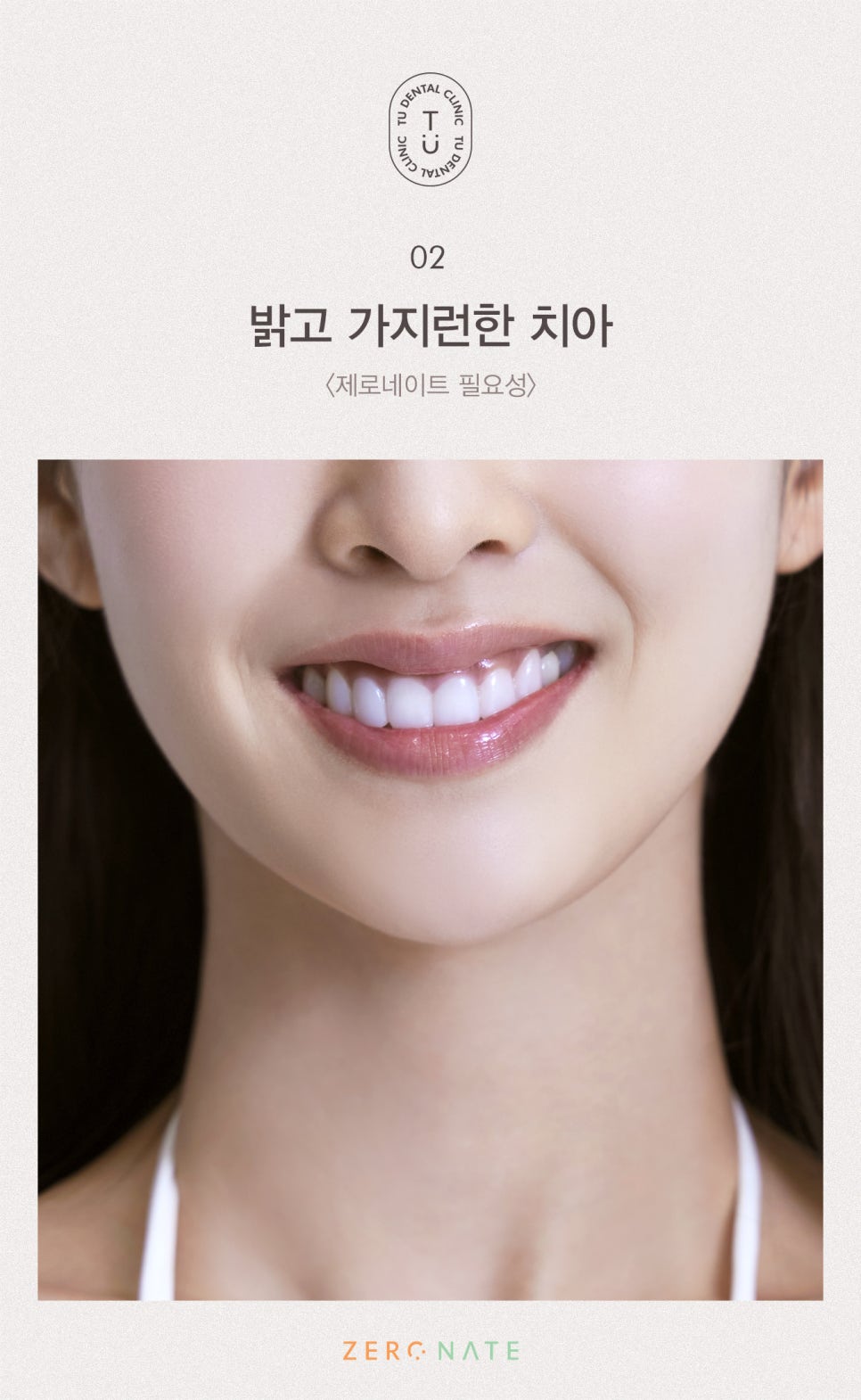 티유치과 제로네이트 가격 설명드립니다 [TU치과] 관련 이미지 3