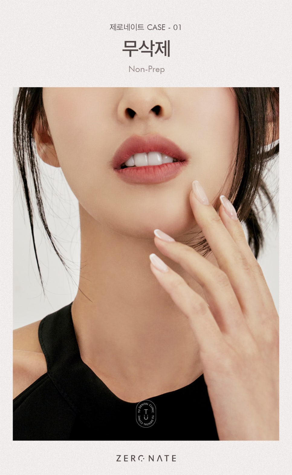 티유치과 제로네이트가 무삭제로 가능한 이유 알려드립니다 [TU치과] 관련 이미지 6