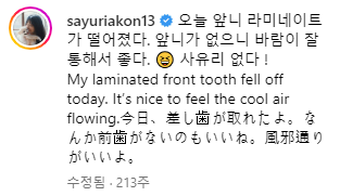 라미네이트 부작용, 떨어지는 이유 알려드립니다 관련 이미지 6