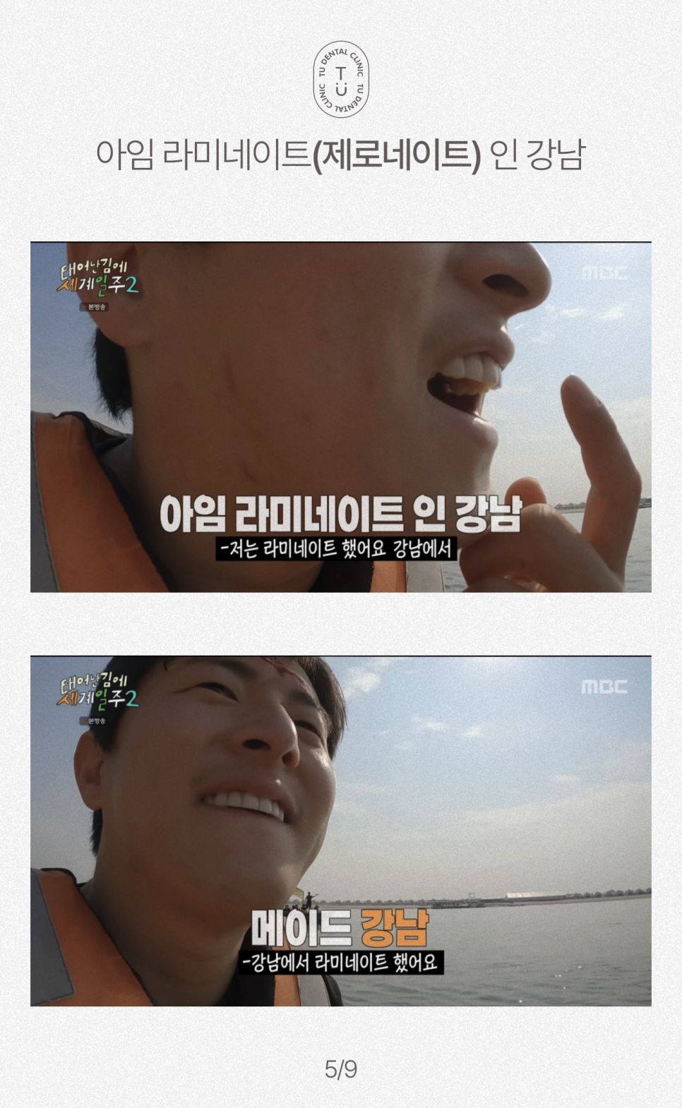 기안84 라미네이트 바로 여기서 했습니다 [TU치과] 관련 이미지 6