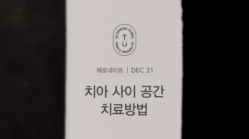 치아 사이 공간 치료방법, 티유치과[TU치과] 관련 이미지 1
