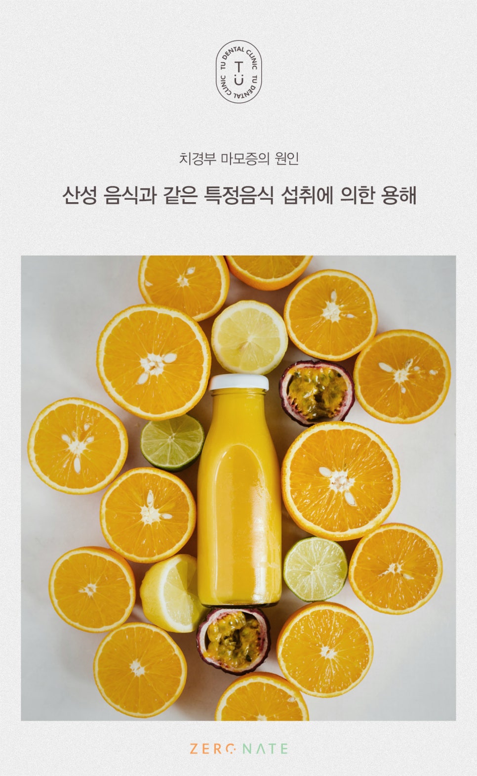 치경부 마모증 치료방법, 티유치과 제로네이트[TU치과] 관련 이미지 6