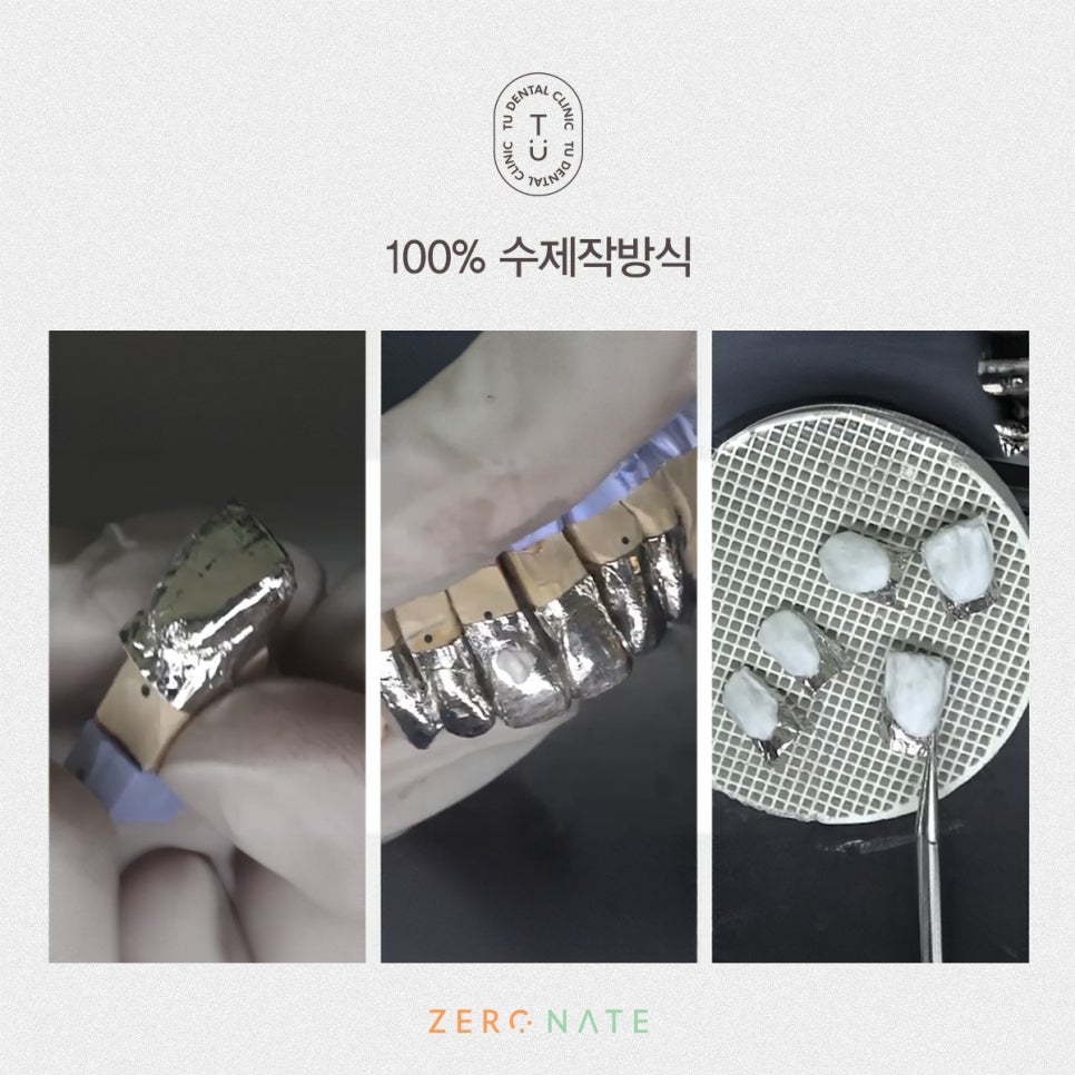 티유치과 무삭제 라미네이트와 제로네이트의 차이는?[TU치과] 관련 이미지 4