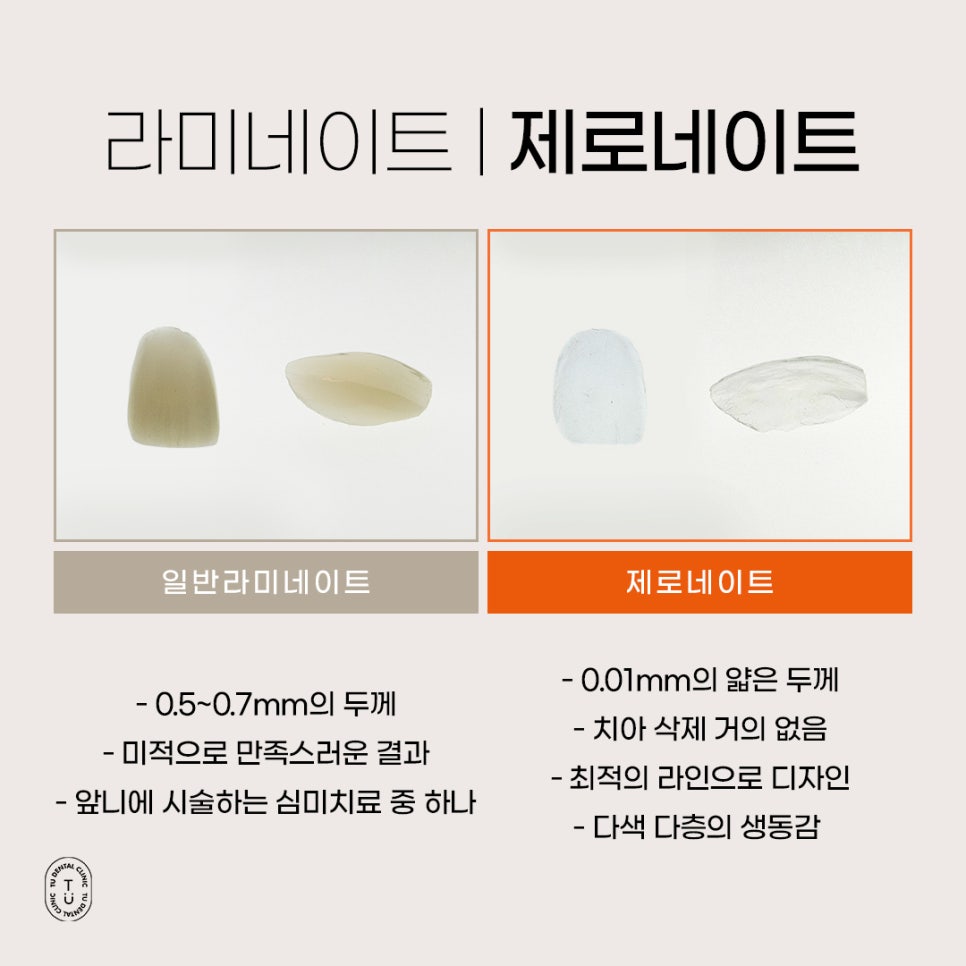 기존 자연치아를 보존하는 라미네이트 방법은? 관련 이미지 2