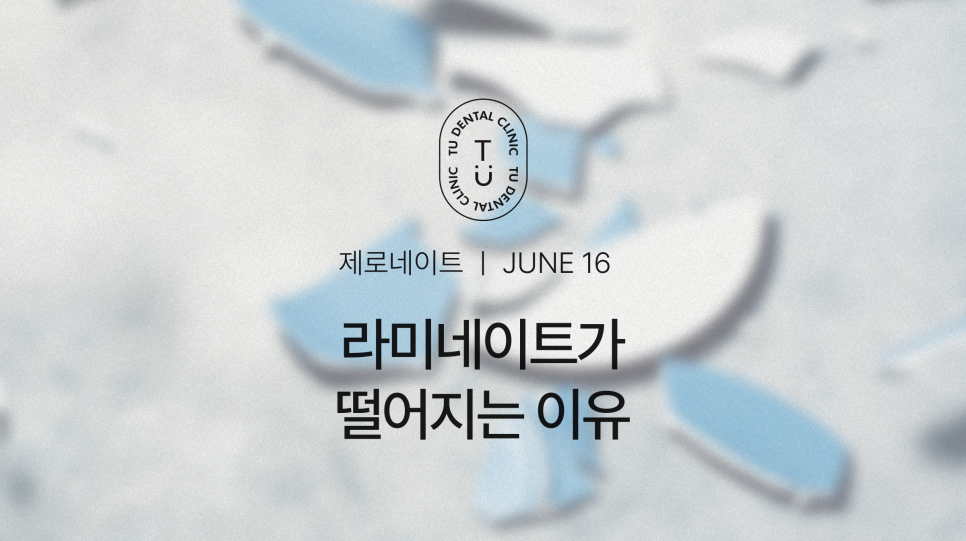 라미네이트 부작용, 떨어지는 이유 알려드립니다 관련 이미지 1