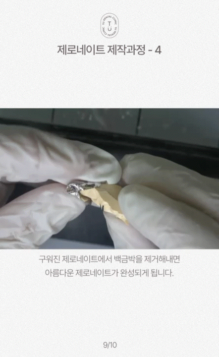 제로네이트 제작 과정 알려드립니다, 티유치과[TU치과] 관련 이미지 10