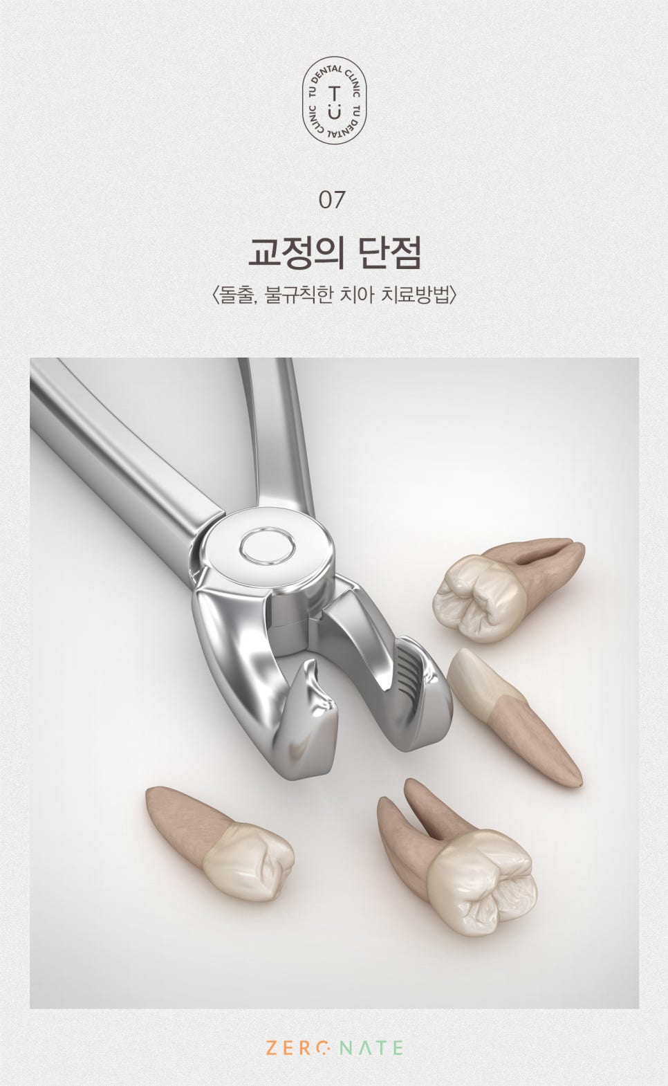 티유치과 돌출,불규칙한 치아 제로네이트[TU치과] 관련 이미지 8