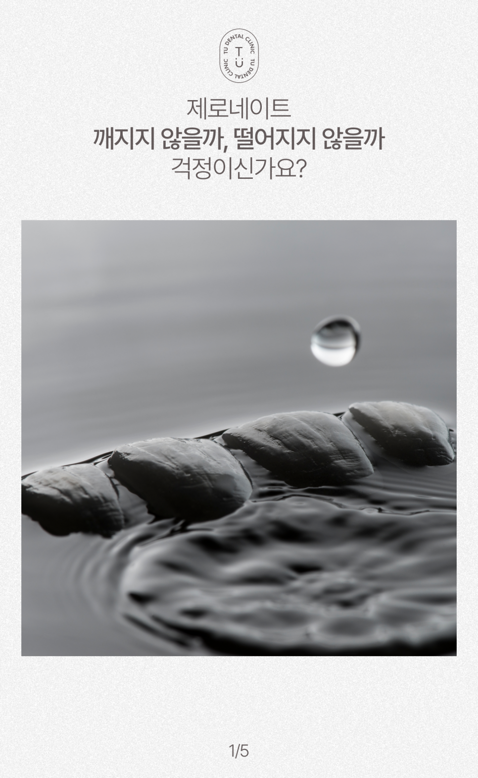 무삭제 라미네이트, 제로네이트 깨질까봐 걱정이신가요? [TU치과] 관련 이미지 2