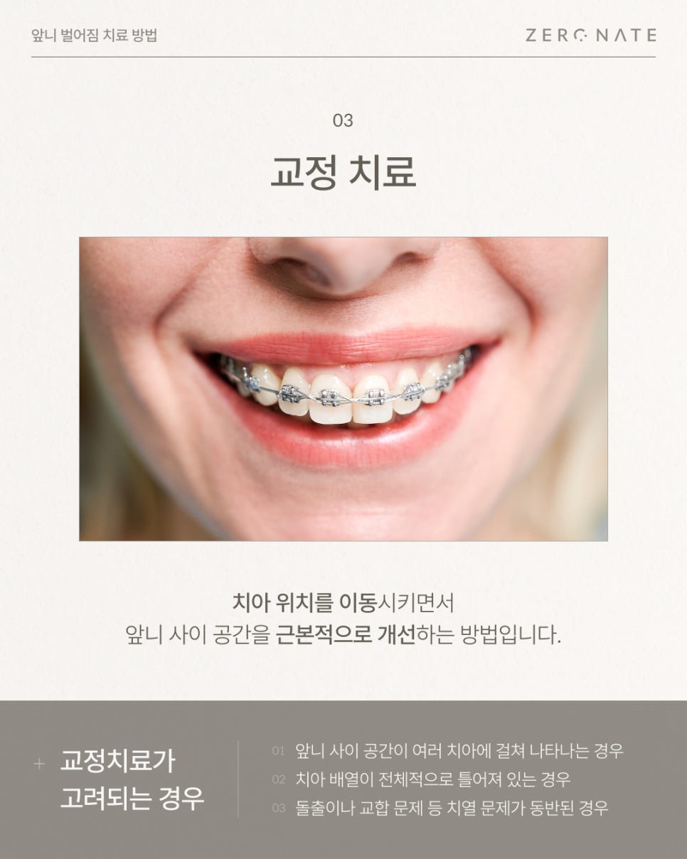 앞니벌어짐 원인부터 치료 방법 총정리 (레진, 라미네이트, 교정) 관련 이미지 8