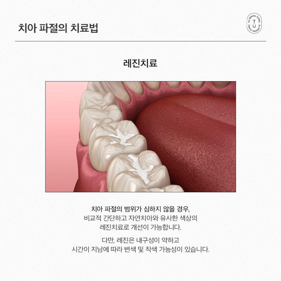 [티유치과] 치아 파절의 치료법, 제로네이트 관련 이미지 4