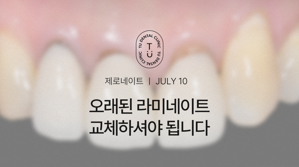 오래된 라미네이트 교체하셔야 됩니다, 티유치과[TU치과] 관련 이미지 1