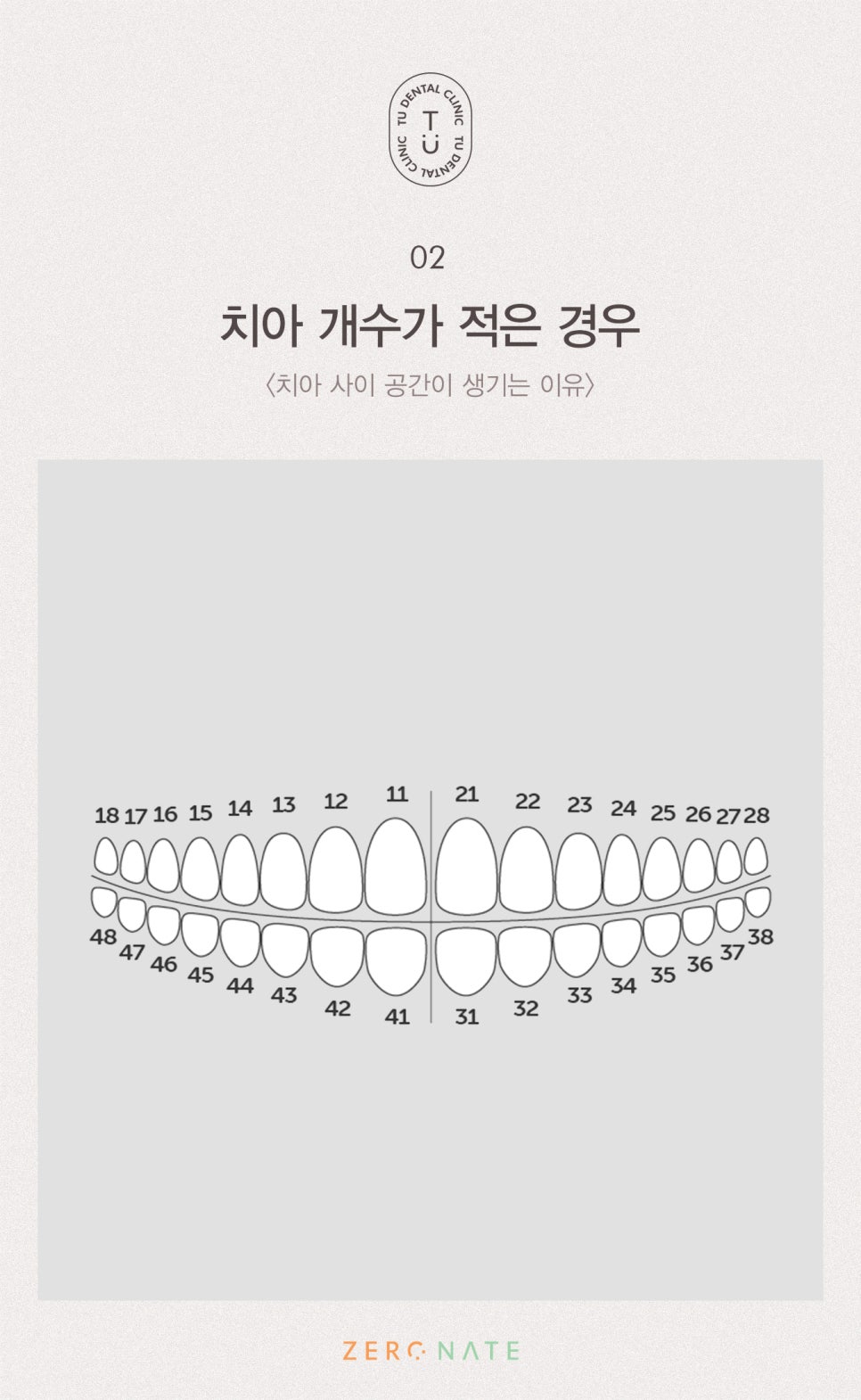 치아 사이 공간 치료방법, 티유치과[TU치과] 관련 이미지 3