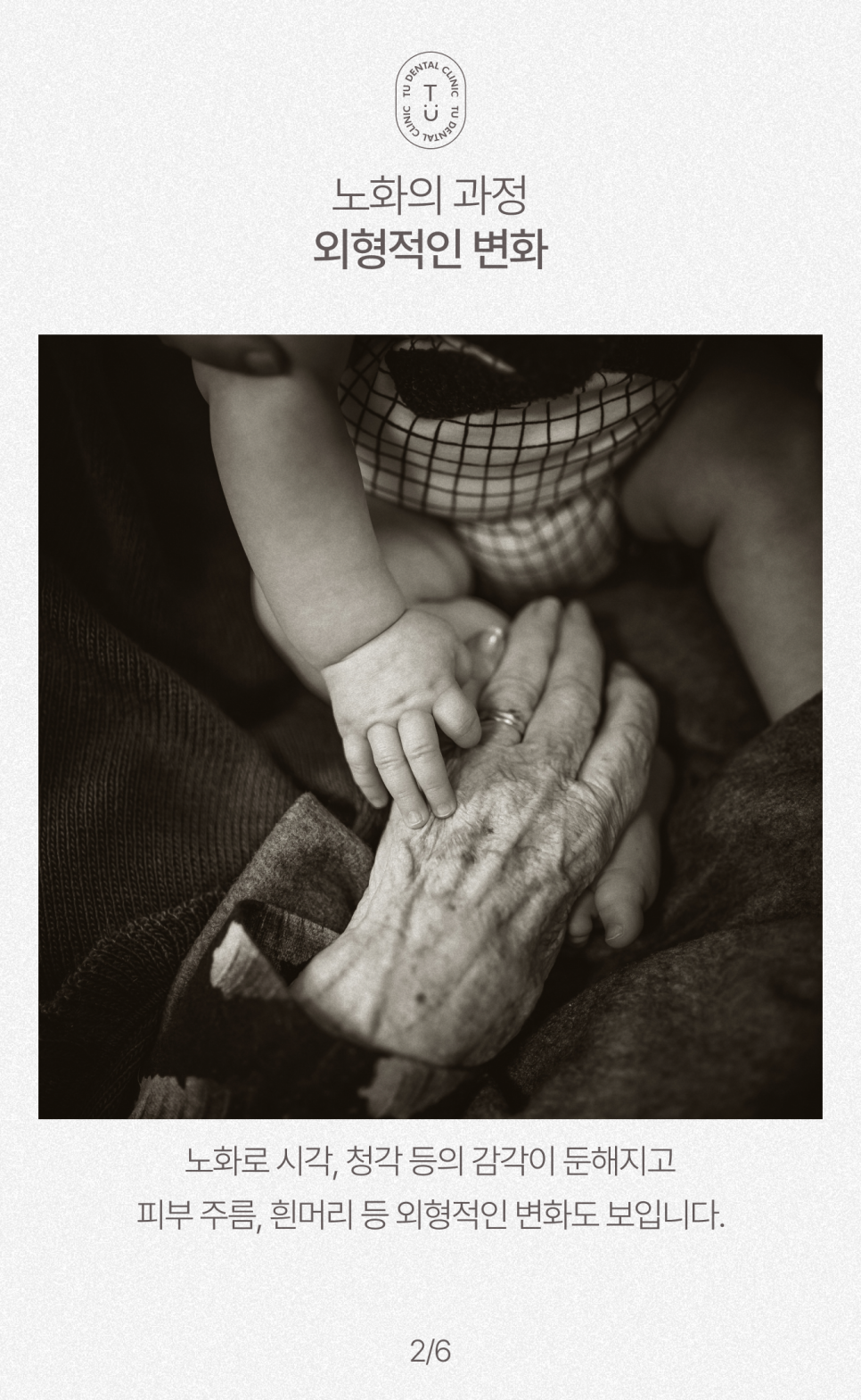 노화된 치아에 제로네이트 하세요, 티유치과[TU치과] 관련 이미지 3