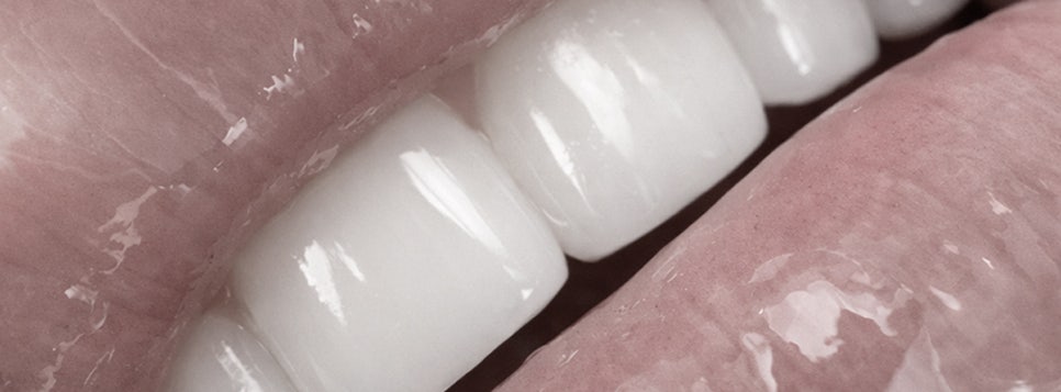 Why Do Celebrities’ Teeth Look More Beautiful? image 15