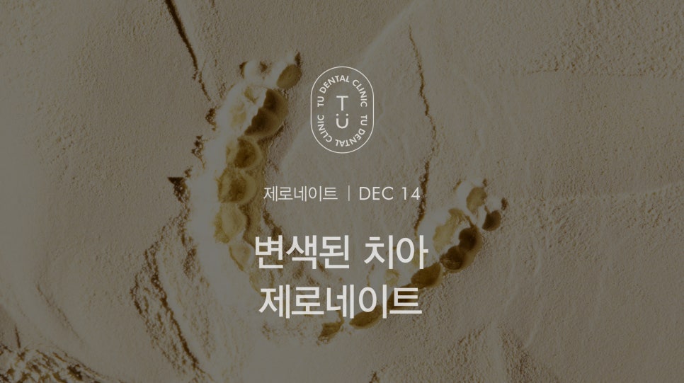 변색된 치아 치료방법, 티유치과 제로네이트 [TU치과] 관련 이미지 1