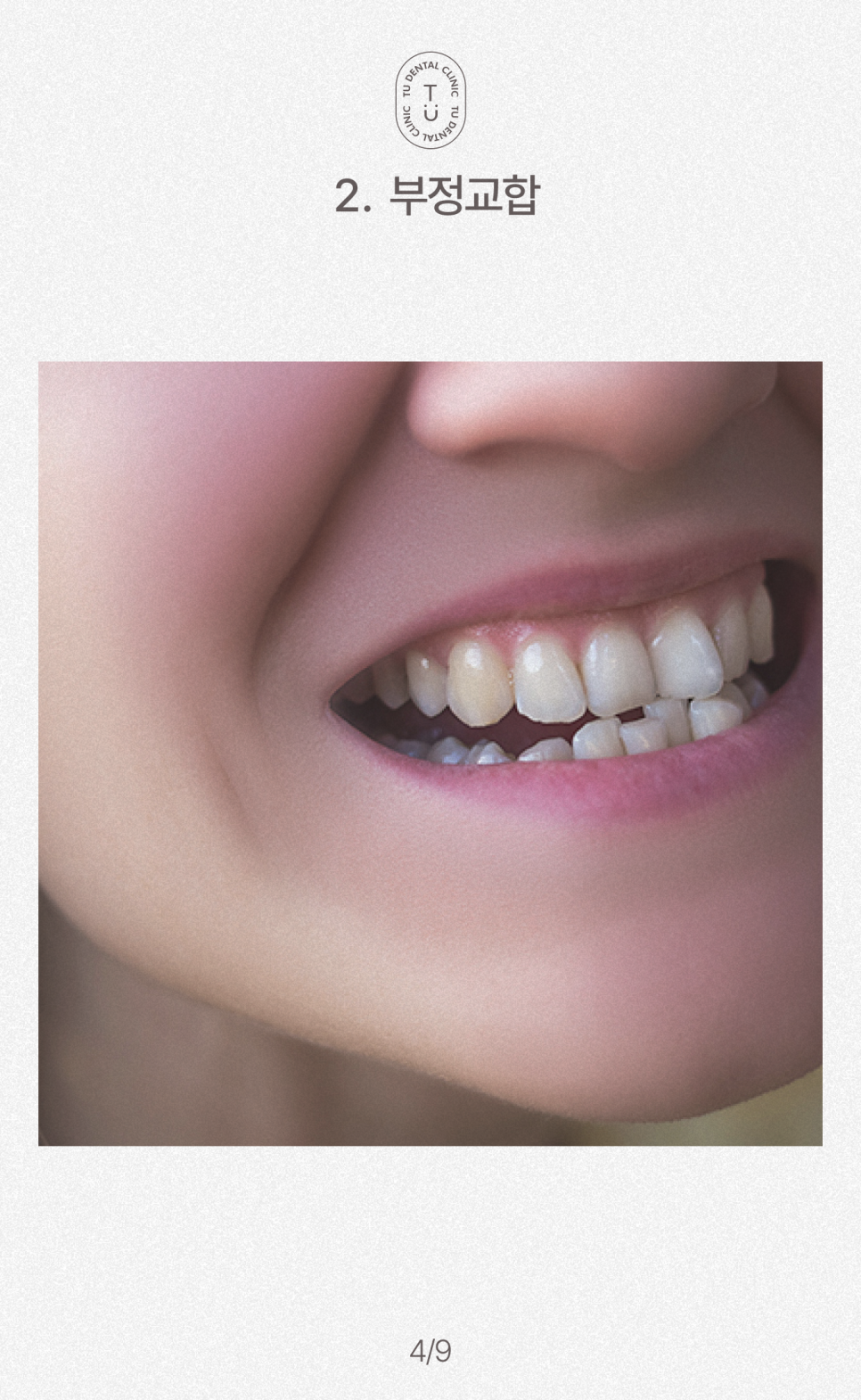 턱에서 딱 소리 나는 이유, 턱관절 장애 원인, 치료, 예방법[TU치과] 관련 이미지 5