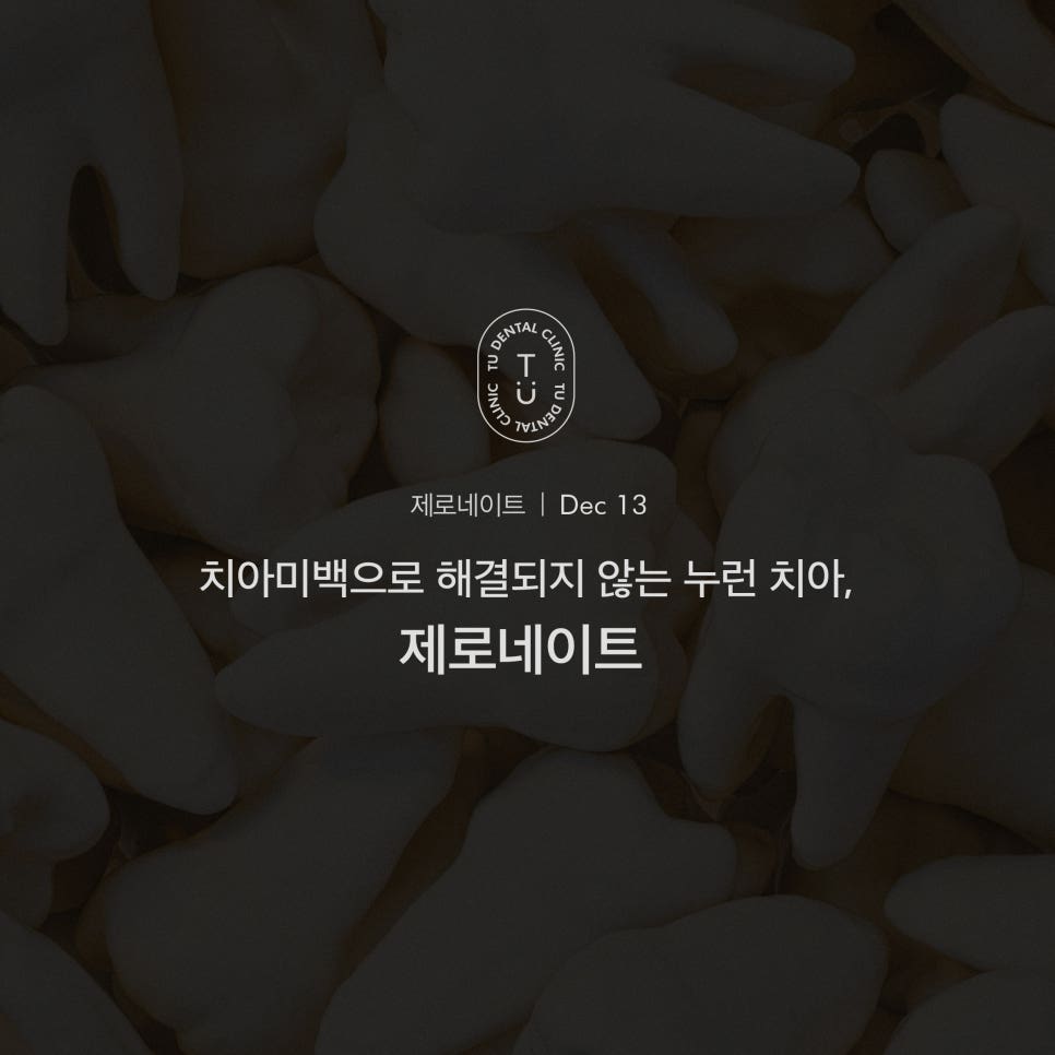 [티유치과] 치아미백으로 해결되지 않는 변색 치아의 치료법, 제로네이트 관련 이미지 1