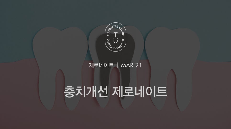 충치의 개선 제로네이트[TU치과] 관련 이미지 1