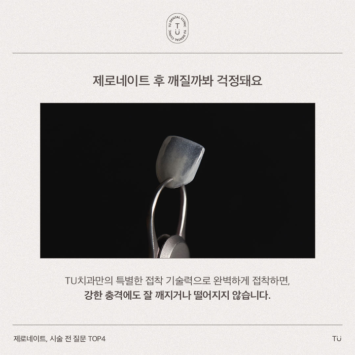 [티유치과] 제로네이트, 시술 전 질문 TOP4 [TU치과] 관련 이미지 3