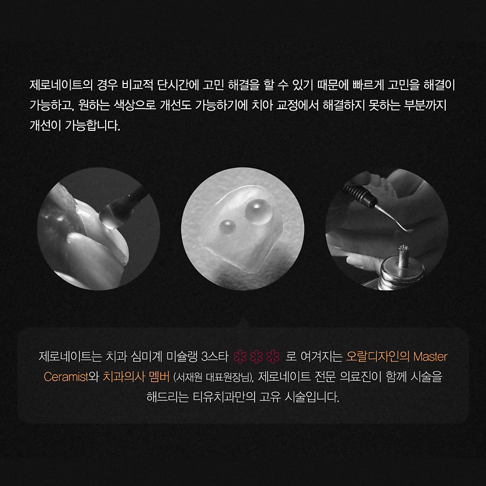 티유치과 3월 매거진 돌출, 불규칙한 치아의 치료법 [TU치과] 관련 이미지 8