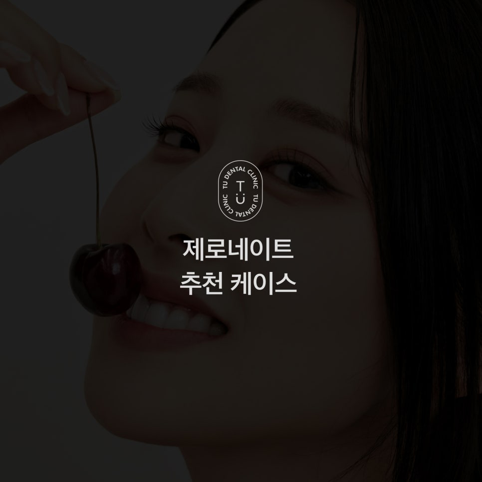 내 치아도 제로네이트 될까? (제로네이트 후기) 관련 이미지 1