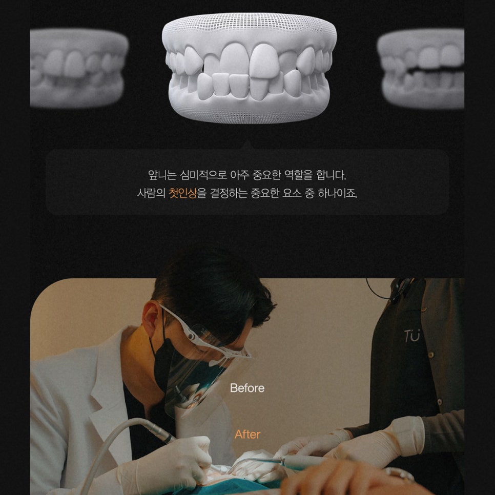 티유치과 3월 매거진 돌출, 불규칙한 치아의 치료법 [TU치과] 관련 이미지 2