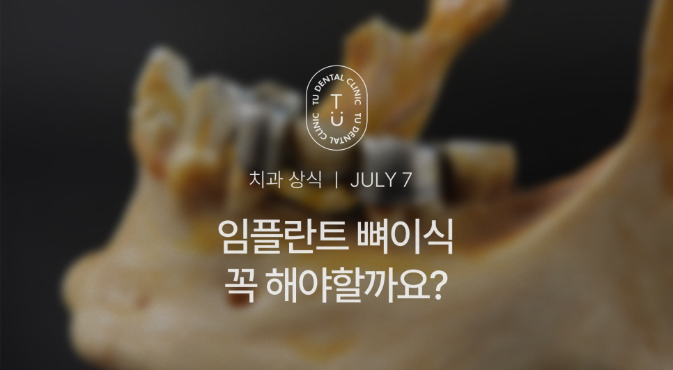임플란트 뼈이식 꼭 해야할까요? 티유치과[TU치과] 관련 이미지 1