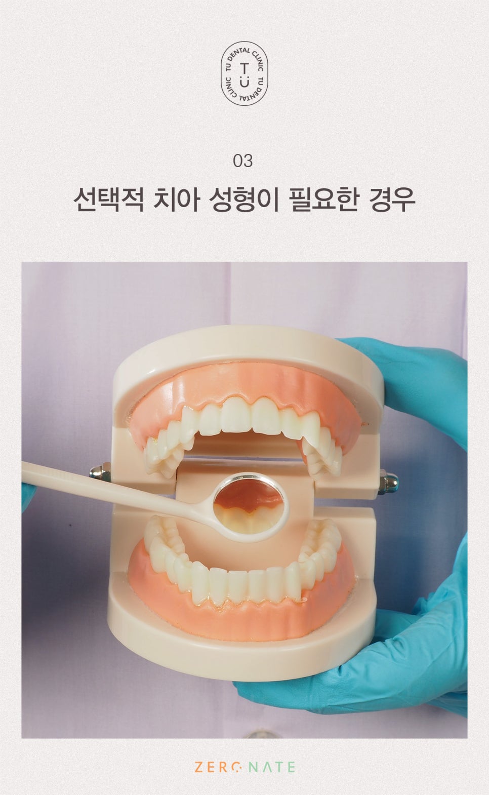티유치과 선택적 치아 성형 [TU치과] 관련 이미지 4