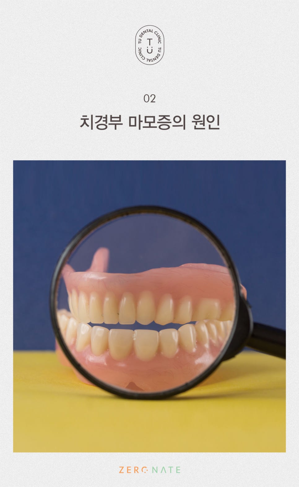 치경부 마모증 치료방법, 티유치과 제로네이트[TU치과] 관련 이미지 3