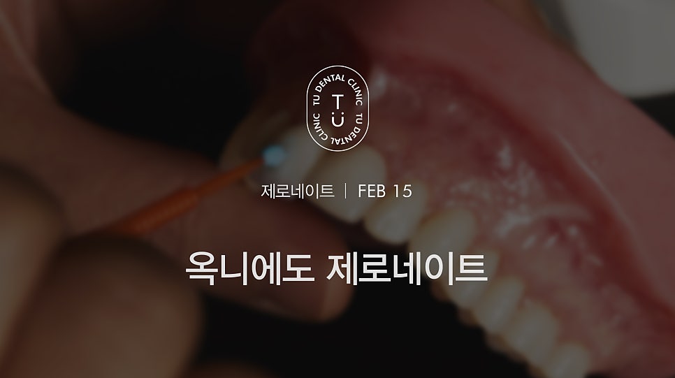 티유치과 옥니 치료법, 옥니에도 제로네이트 [TU치과] 관련 이미지 1