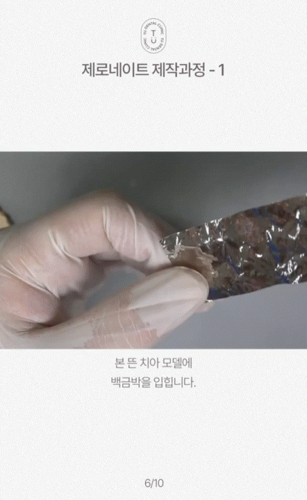 제로네이트 제작 과정 알려드립니다, 티유치과[TU치과] 관련 이미지 7