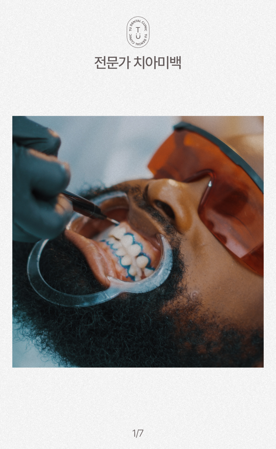 치아 반영구적으로 하얘지는 법, 티유치과[TU치과] 관련 이미지 2