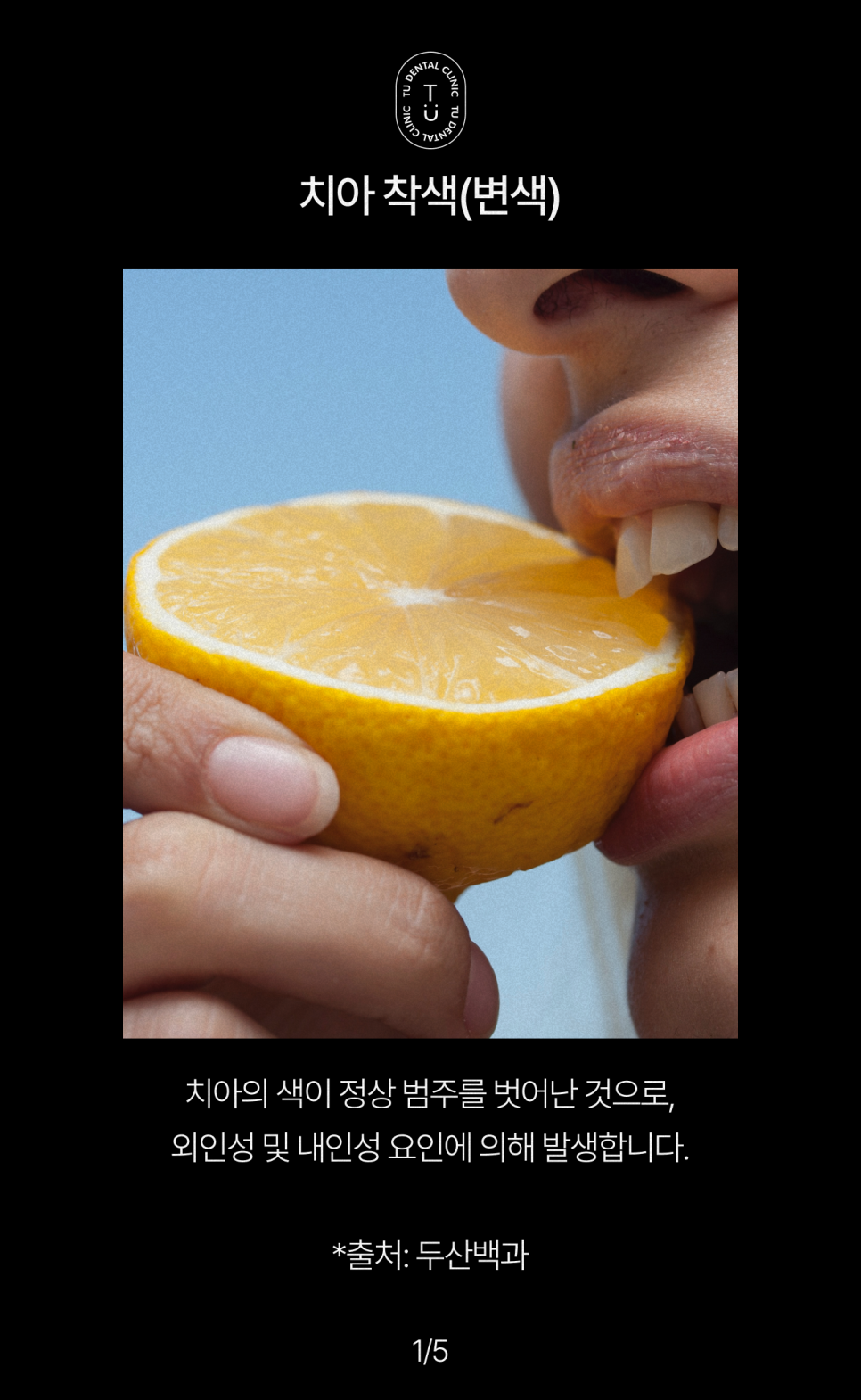 치아 착색 유발 음식 TOP3, 티유치과[TU치과] 관련 이미지 2